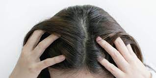 Kulit Kepala Sensitif Saran dari Ahli Kesehatan Rambut