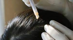 Pentingnya Detoksifikasi Rambut untuk Kesehatan Kulit Kepala